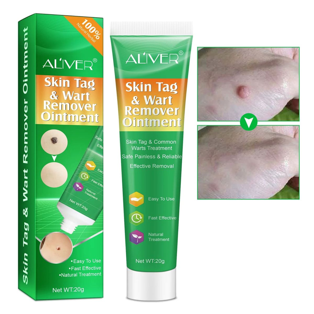 Aliver Skin Tag & Wart Remover Ointment Cream 20G Aliver - Women's Personal Care 4