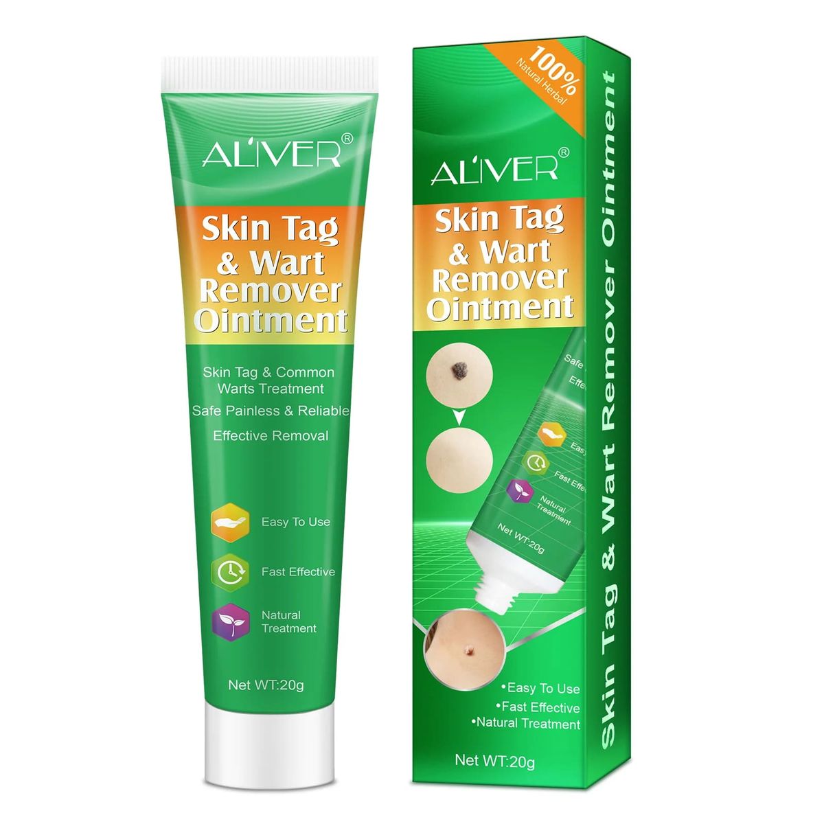 Aliver Skin Tag & Wart Remover Ointment Cream 20G Aliver - Women's Personal Care