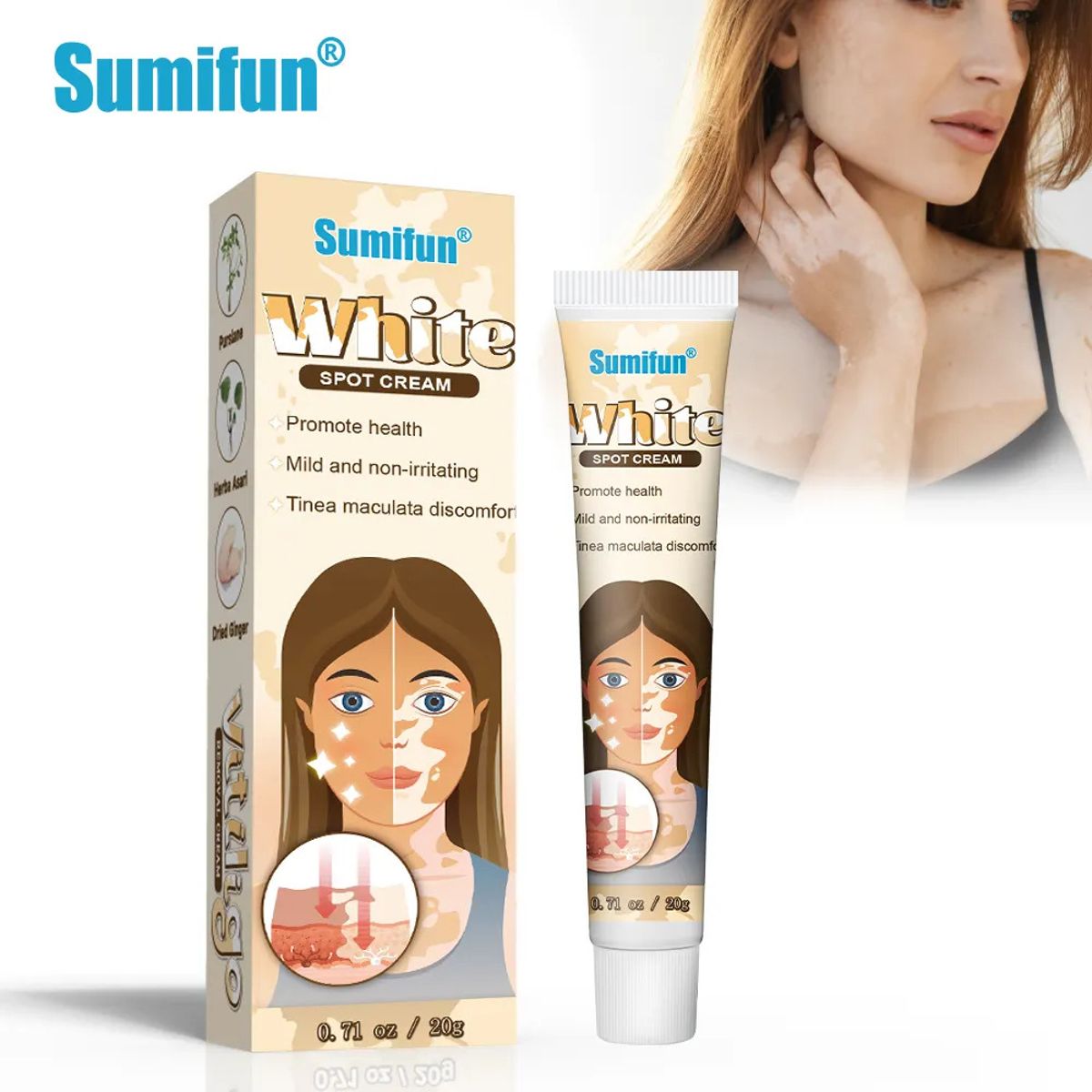 Sumifun White Spot Cream, Vitiligo Removal Cream 20g Sumifun White Spot Cream, Vitiligo Removal Cream 20g