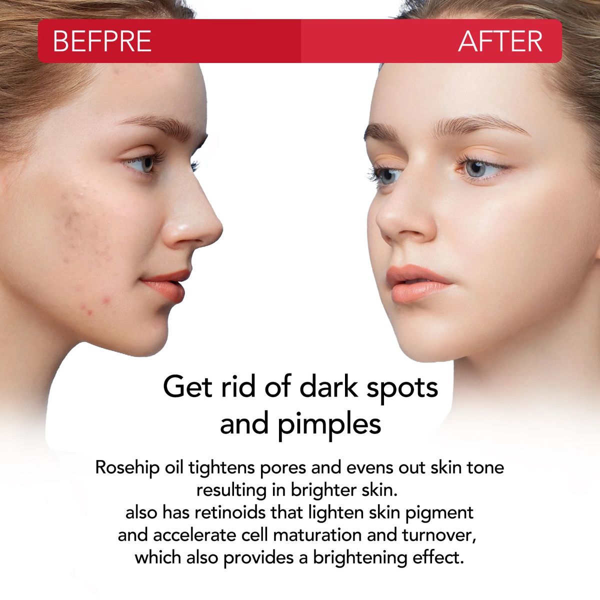 Aliver Rosehip Oil For Face, Hair & Body