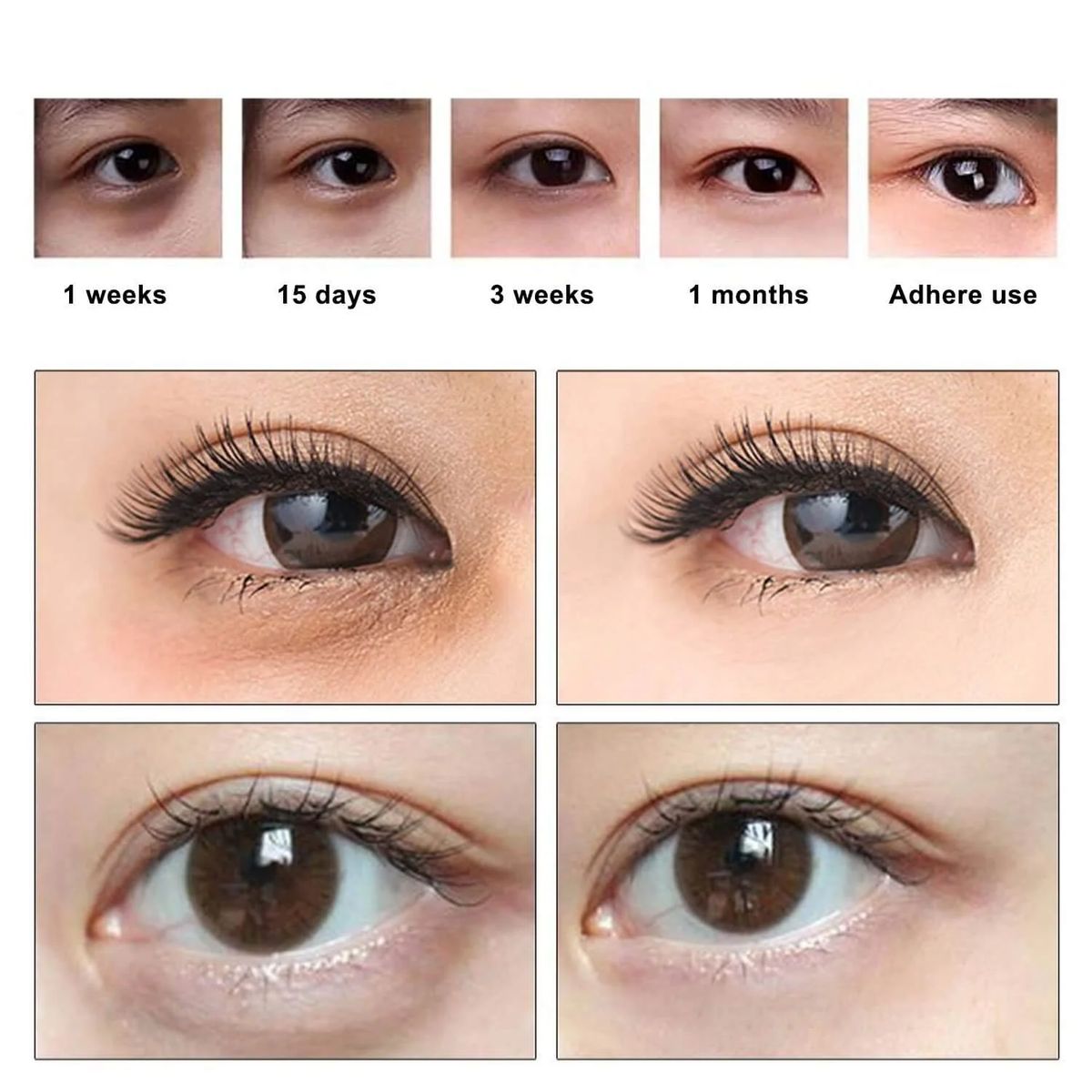 Aliver Hydrogel Eye Mask 60Pcs / 170G