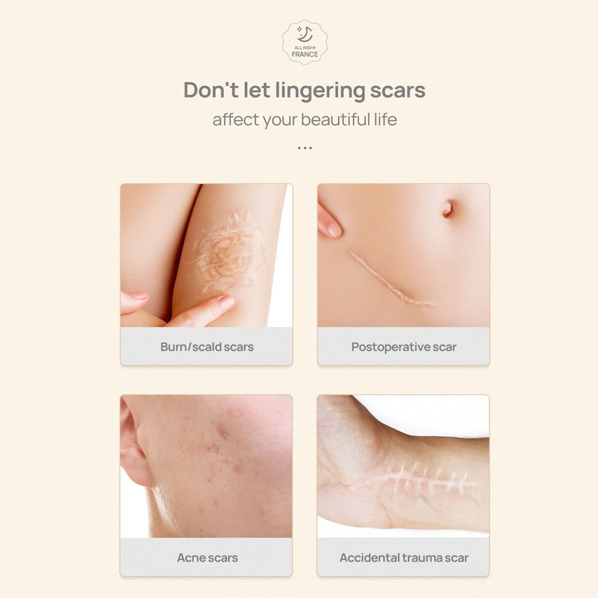 Lanbena Scar Removal Stretch Marks Cream 40G