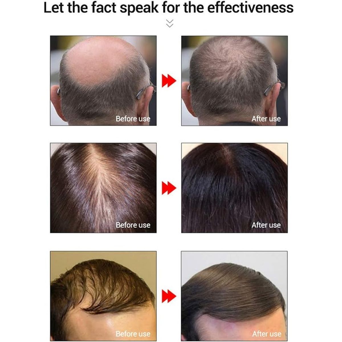 Lanbena Hair Growth Essential Oil 20ML