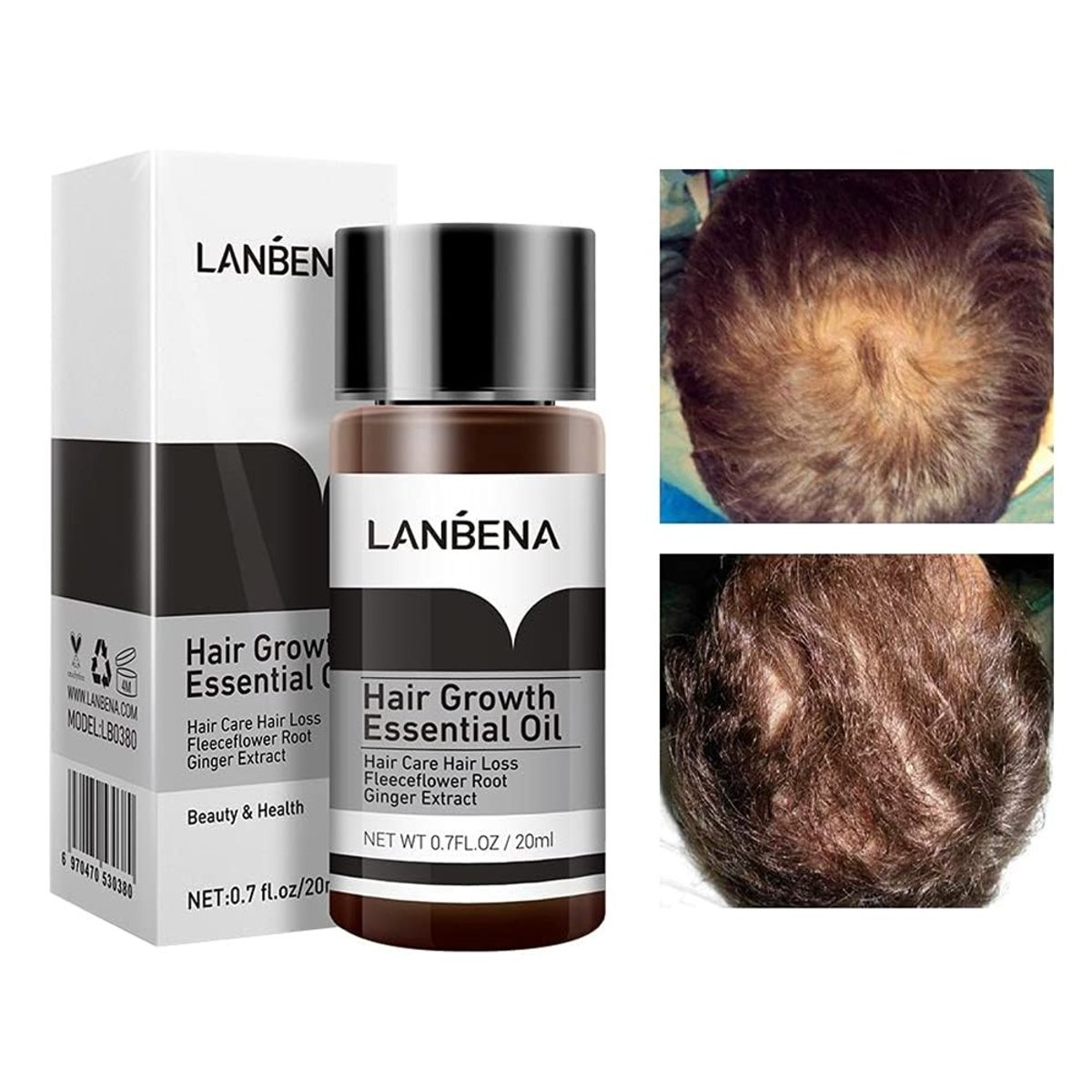 Lanbena Hair Growth Essential Oil 20ML