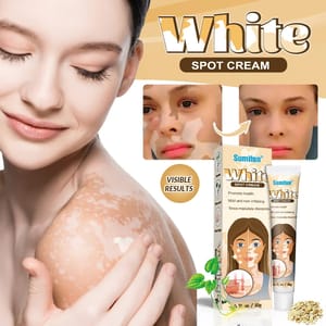 Sumifun White Spot Cream, Vitiligo Removal Cream 20g Sumifun White Spot Cream, Vitiligo Removal Cream 20g