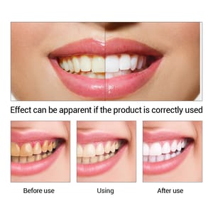 Lanbena Teeth Whitening Essence 10ML Lanbena Teeth Whitening Essence 10ML