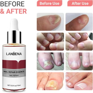 Lanbena Nail Repair Essence 15ML Lanbena - Women's Nail Polish 2