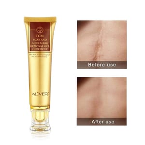 Aliver 30g TCM Scar and Acne Mark Removal Gel Ointment