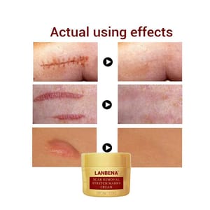 Lanbena Scar Removal Stretch Marks Cream 40G