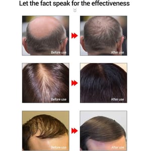 Lanbena Hair Growth Essential Oil 20ML